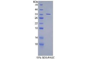 Image no. 1 for Suppressor of Variegation 4-20 Homolog 2 (SUV420H2) (AA 2-279) protein (His tag) (ABIN1080876)