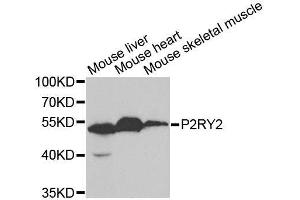 Image no. 1 for anti-Purinergic Receptor P2Y, G-Protein Coupled, 2 (P2RY2) antibody (ABIN6145129)