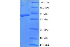 Image no. 1 for Dickkopf 2 Homolog (Xenopus Laevis) (DKK2) (AA 34-259) protein (His-SUMO Tag) (ABIN5711797)