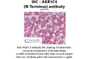 Image no. 1 for anti-Aldo-keto Reductase Family 1 Member C4 (AKR1C4) (N-Term) antibody (ABIN1731645)