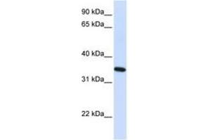 Image no. 1 for anti-Reticulon 1 (RTN1) (AA 36-85) antibody (ABIN6741062)