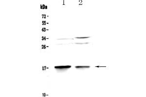 MAP1LC3A Antikörper  (AA 1-120)