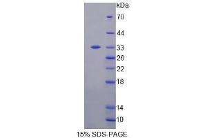 Image no. 1 for Homeodomain Interacting Protein Kinase 3 (HIPK3) (AA 1-264) protein (His tag) (ABIN6239715)