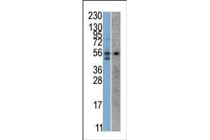 Image no. 1 for anti-serine/threonine Kinase 38 (STK38) (AA 410-439), (C-Term) antibody (ABIN391097)