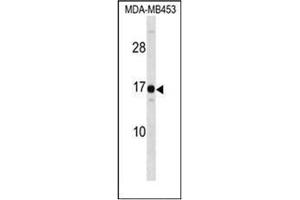 Image no. 2 for anti-High Mobility Group Nucleosomal Binding Domain 3 (HMGN3) (AA 1-30), (N-Term) antibody (ABIN952763)