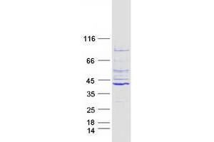 Image no. 1 for Leucine Rich Repeat Containing 39 (LRRC39) protein (Myc-DYKDDDDK Tag) (ABIN2724914)