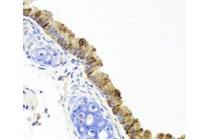 Immunohistochemistry of paraffin-embedded Mouse lung using TOPBP1 Polyclonal Antibody at dilution of 1:100 (40x lens).