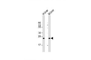 Image no. 4 for anti-Hyaluronan Binding Protein 2 (HABP2) (AA 378-408), (C-Term) antibody (ABIN651853)