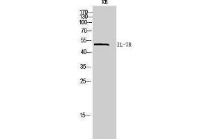 Image no. 1 for anti-Interleukin 7 Receptor (IL7R) (Internal Region) antibody (ABIN3181445)
