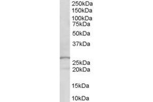 Image no. 1 for anti-Acyl-CoA Dehydrogenase Family, Member 10 (ACAD10) (C-Term) antibody (ABIN2788578)