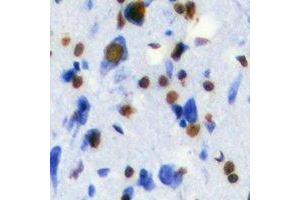 Image no. 2 for anti-Transketolase (TKT) antibody (ABIN3198354)
