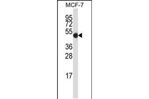 Image no. 1 for anti-GDP Dissociation Inhibitor 2 (GDI2) (AA 135-164) antibody (ABIN5533340)