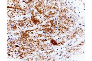 Immunohistochemistry (Paraffin-embedded Sections) (IHC (p)) image for anti-Clathrin (AA 4-171) antibody (ABIN968006)