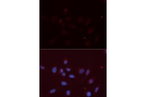 Image no. 2 for anti-Amyloid beta (A4) Precursor-Like Protein 2 (APLP2) antibody (ABIN1876643)