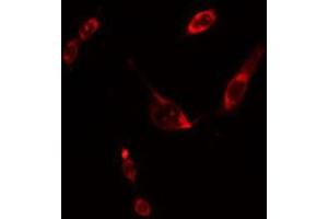 Image no. 1 for anti-Son of Sevenless Homolog 2 (SOS2) (Internal Region) antibody (ABIN6259240)