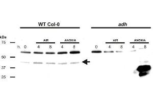 Image no. 1 for anti-Alcohol Dehydrogenase (ADH) antibody (ABIN619537)