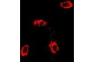 Image no. 1 for anti-RAB11A, Member RAS Oncogene Family (RAB11A) (full length) antibody (ABIN6004832)