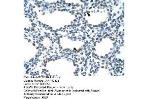 Image no. 2 for anti-Transformer 2 beta Homolog (TRA2B) (N-Term) antibody (ABIN2778898)