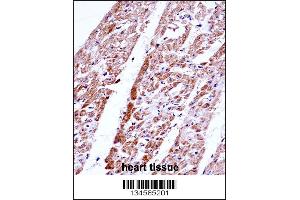 Image no. 1 for anti-Follistatin (FST) (AA 312-340), (C-Term) antibody (ABIN5534422)