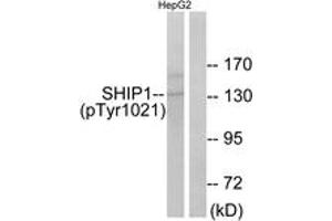 Western blot analysis of extracts from HepG2 cells treated with TNF 200NG/ML 30', using SHIP1 (Phospho-Tyr1021) Antibody.