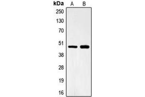 Image no. 1 for anti-Forkhead Box B2 (FOXB2) (Center) antibody (ABIN2706166)
