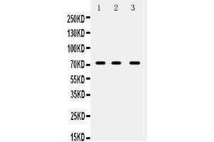 Image no. 1 for anti-ATP-Binding Cassette, Sub-Family G (WHITE), Member 5 (ABCG5) (AA 197-221), (N-Term) antibody (ABIN3043776)