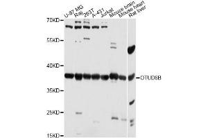 Image no. 1 for anti-OTU Domain Containing 6B (OTUD6B) antibody (ABIN6293808)