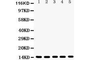 Image no. 2 for anti-Profilin 1 (PFN1) (AA 116-140), (C-Term) antibody (ABIN3043603)