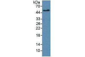Image no. 2 for Receptor tyrosine-protein kinase erbB-2 (ErbB2/Her2) ELISA Kit (ABIN6730948)