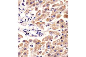 Image no. 9 for anti-alpha-2-HS-Glycoprotein (AHSG) (AA 247-276), (C-Term) antibody (ABIN654065)