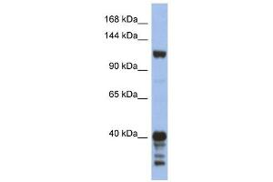 Image no. 1 for anti-Signal-Induced Proliferation-Associated 1 (SIPA1) (Middle Region) antibody (ABIN634653)
