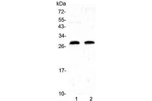 Image no. 1 for anti-C-Reactive Protein (CRP) (AA 20-230) antibody (ABIN6654108)