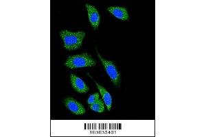 Image no. 3 for anti-Death-Associated Protein Kinase 1 (DAPK1) (AA 1360-1389), (C-Term) antibody (ABIN391321)