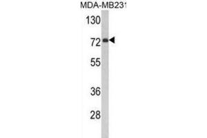 Image no. 2 for anti-Flavin Containing Monooxygenase 3 (FMO3) antibody (ABIN3002867)