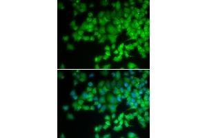 Image no. 2 for anti-Neutrophil Cytosolic Factor 4, 40kDa (NCF4) antibody (ABIN3022903)