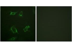 Immunofluorescence analysis of HepG2 cells, using PLD1 (Phospho-Ser561) Antibody.