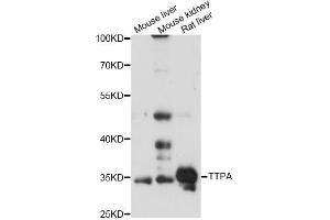 Image no. 1 for anti-Tocopherol (Alpha) Transfer Protein (TTPA) antibody (ABIN6293751)