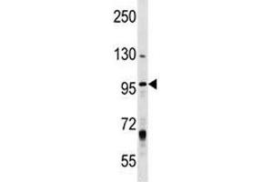 MCM8 antibody  (AA 322-350)