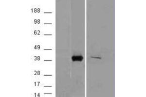 Image no. 1 for anti-Aldo-Keto Reductase Family 1, Member B10 (Aldose Reductase) (AKR1B10) (C-Term) antibody (ABIN238673)