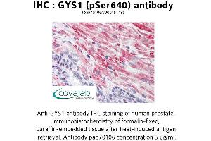 Image no. 1 for anti-Glycogen Synthase 1 (Muscle) (GYS1) (pSer640) antibody (ABIN1734828)