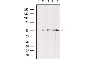 Image no. 1 for anti-Glutamate-Cysteine Ligase, Catalytic Subunit (GCLC) (N-Term) antibody (ABIN6261919)
