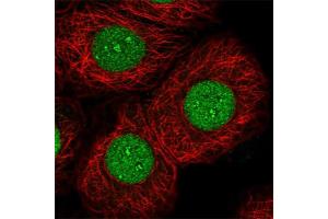 Image no. 2 for anti-Nuclear Factor I/C (CCAAT-Binding Transcription Factor) (NFIC) antibody (ABIN5584435)