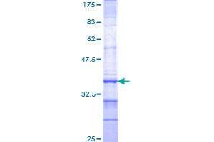 Image no. 1 for Diencephalon/mesencephalon Homeobox 1 (DMBX1) (AA 1-88) protein (GST tag) (ABIN1351713)