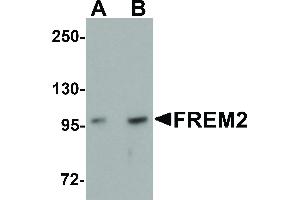FREM2 antibody  (Internal Region)