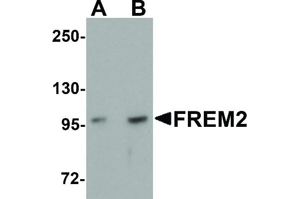 FREM2 antibody  (Internal Region)