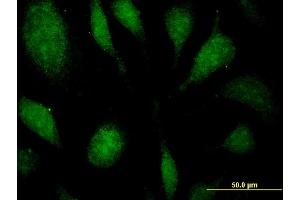 Image no. 4 for anti-Eukaryotic Translation Elongation Factor 1 delta (Guanine Nucleotide Exchange Protein) (EEF1D) (AA 1-91) antibody (ABIN515171)