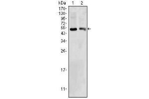 Image no. 2 for anti-3-hydroxybutyrate Dehydrogenase, Type 1 (BDH1) antibody (ABIN1105510)