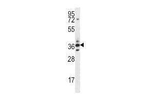 Image no. 1 for anti-Secreted Frizzled-Related Protein 5 (SFRP5) (AA 190-219) antibody (ABIN656890)