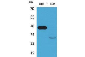 Image no. 1 for anti-Cathepsin L1 (CTSL1) (Internal Region) antibody (ABIN3187674)
