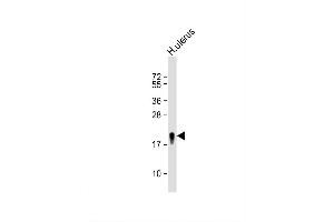 Image no. 4 for anti-Transgelin (TAGLN) (AA 24-51), (N-Term) antibody (ABIN390626)
